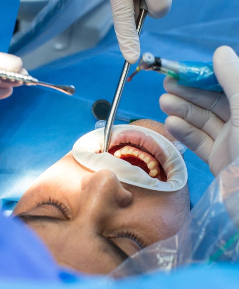 Frecuencia de cepillado con brackets